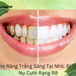 Cách Làm Cho Răng Trắng Sáng Tại Nhà (1)